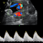 Doppler Obstétrico ($ARS)